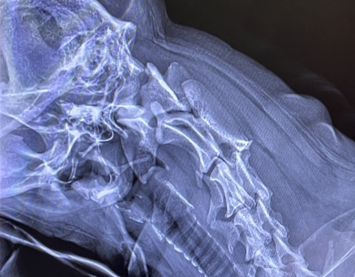 Xray